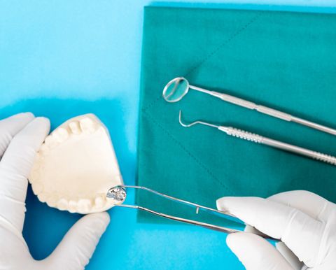 Implant and Prosthodontic Model — Fort Myers, FL — Children & Adult Dentistry Implant and Prosthodontic Model — Fort Myers, FL — Children & Adult Dentistry