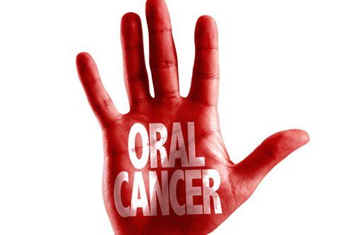 Oral Cancer — Fort Myers, FL — Children & Adult Dentistry Oral Cancer — Fort Myers, FL — Children & Adult Dentistry