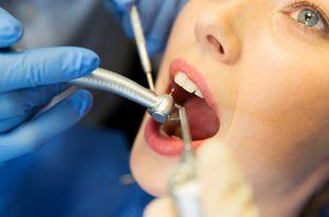 Dentist Patient Showing Perfect Smile — Fort Myers, FL — Children & Adult Dentistry Dentist Patient Showing Perfect Smile — Fort Myers, FL — Children & Adult Dentistry
