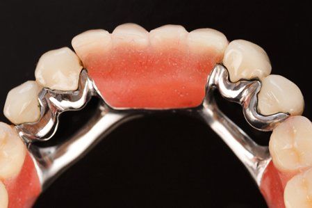 Dentures — Fort Myers, FL — Children & Adult Dentistry Dentures — Fort Myers, FL — Children & Adult Dentistry