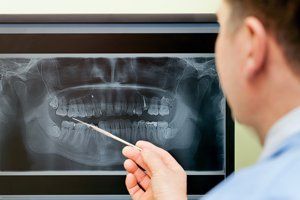 Dental X-Ray — Fort Myers, FL — Children & Adult Dentistry Dental X-Ray — Fort Myers, FL — Children & Adult Dentistry