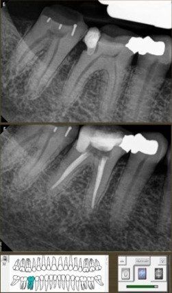 radiographs:first-visit