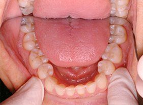 Pre-treatment Assessment