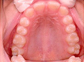 Cosmetic dentistry - 1 before