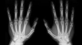 radiologia mani radiologia mani