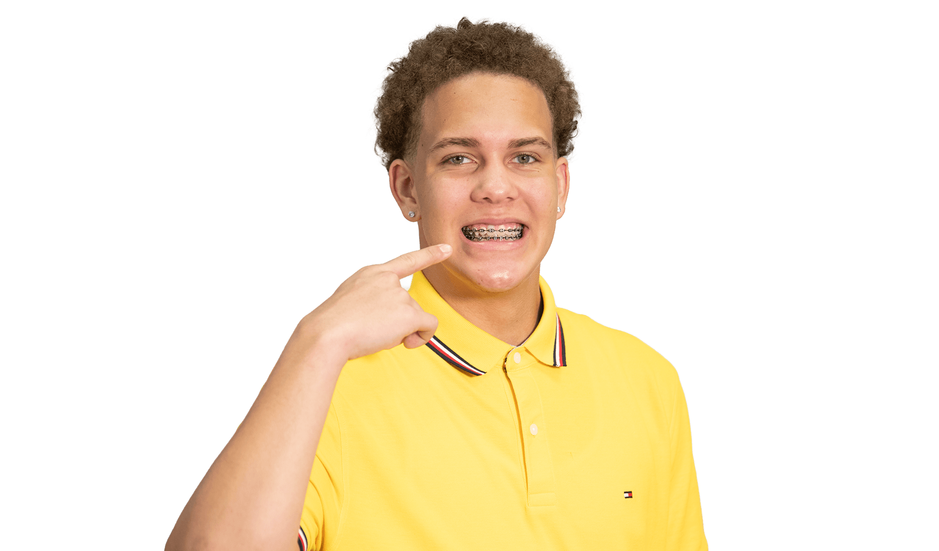 Braces Treatment
