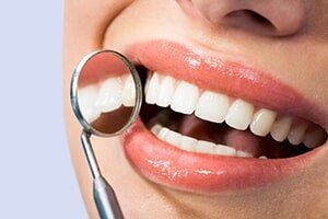 Healthy teeth of a woman Healthy teeth of a woman