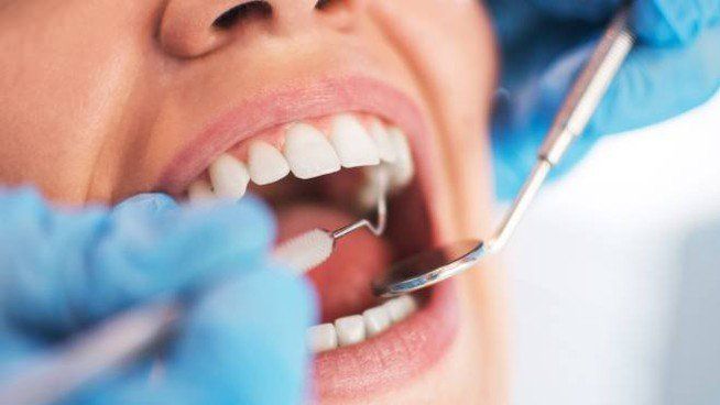 Estrazione dentale