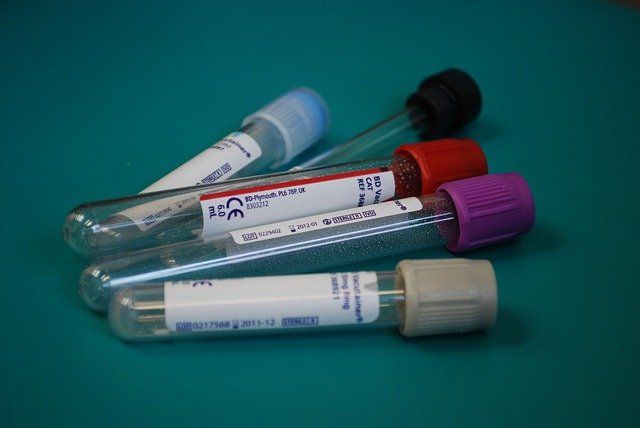 Test Tubes — Redlands, CA — Beloved Foundation