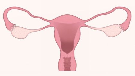 Uterus — Redlands, CA — Beloved Foundation