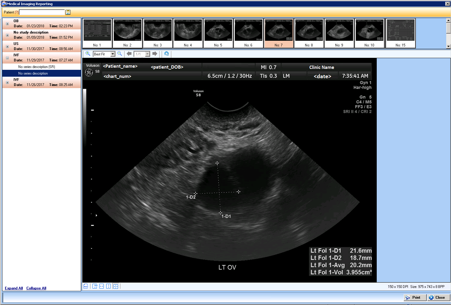 gastroenterology ehr