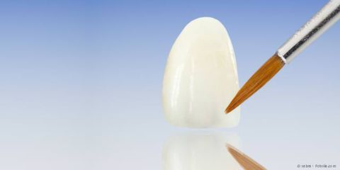 Zahnersatz aus dem praxiseigenen Dental-Labor