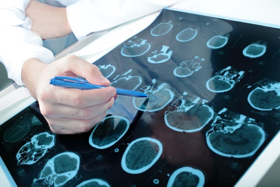 Visita neurologica