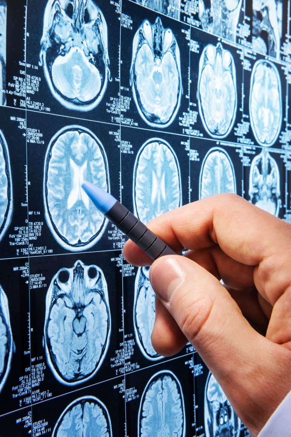 Visita neurologica