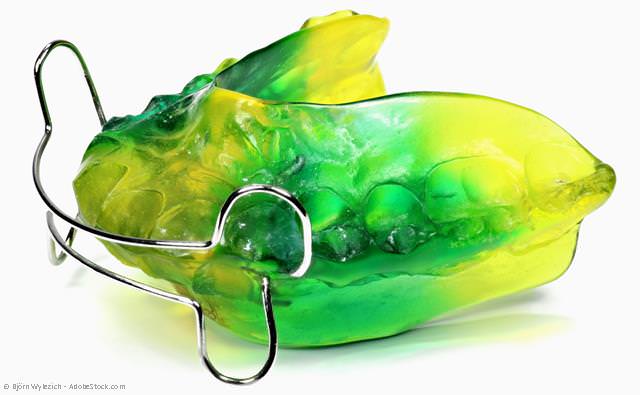 Mit Funktionstherapeutischen Geräten werden Kiefer und Zahnbogen mit Muskelkraft geformt. Mit Funktionstherapeutischen Geräten werden Kiefer und Zahnbogen mit Muskelkraft geformt.