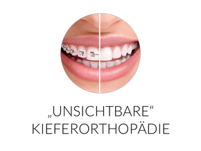 Unsichtbare Kieferorthopädie mit Incognito
