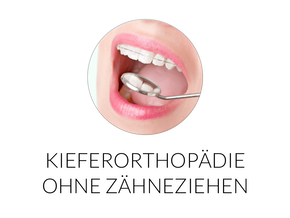 Kieferorthopädie ohne Zähneziehen