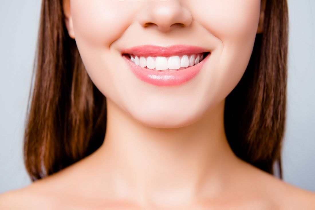 Bonding — Smile Of A Woman After Dental Bonding in Tukwila, WA Bonding — Smile Of A Woman After Dental Bonding in Tukwila, WA