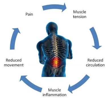 Pain Diagram - Physical Therapy in Bonita Springs, FL Pain Diagram - Physical Therapy in Bonita Springs, FL