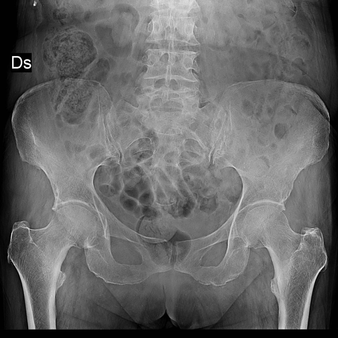 radiografia lombi