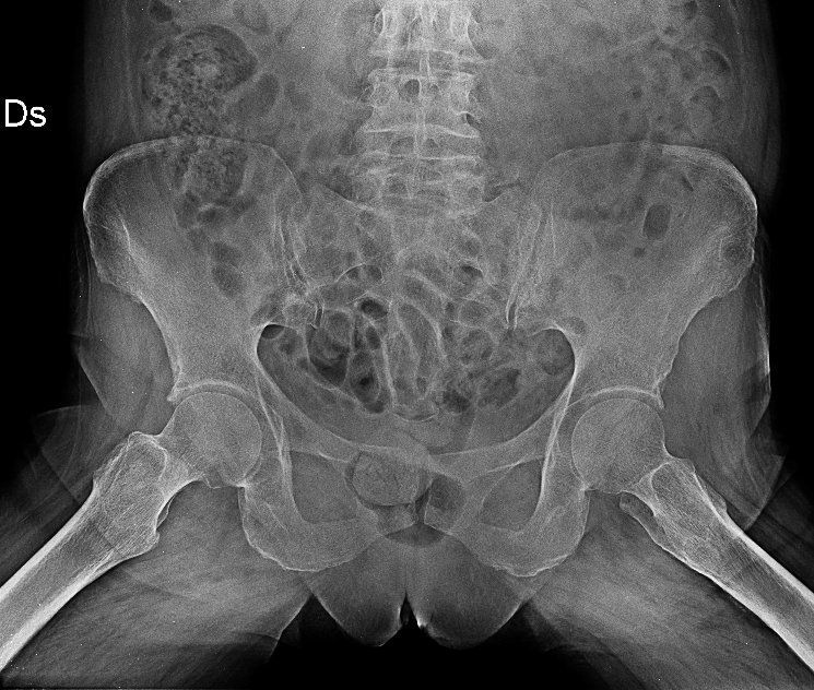 radiografia anche