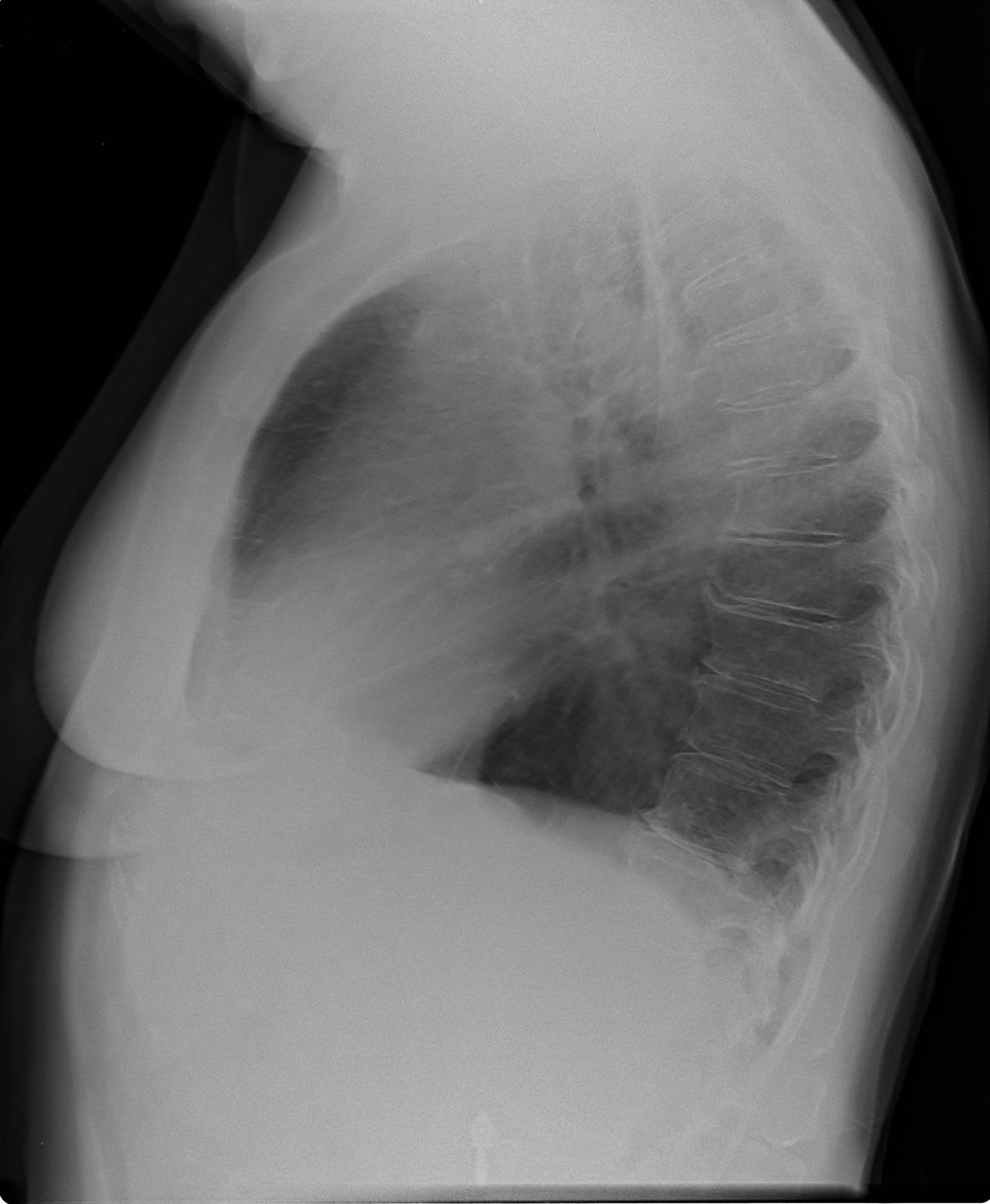 radiografia torace