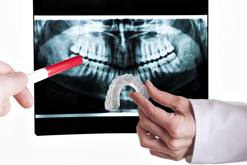 Teeth Grinding Solutions