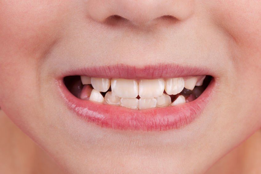 Protecting Teeth Sedation Dentistry Services