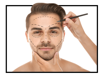 Hair Transplant