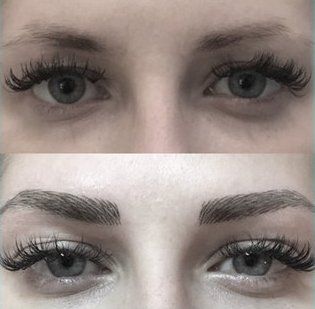 eyebrow treatment