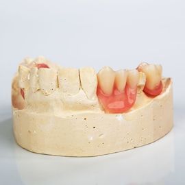 Flexible Partials — Dental Prosthetic Repair in Pinellas Park, FL