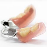 Partial Dentures — Metal Plated Partial Denture in Pinellas Park, FL Partial Dentures — Metal Plated Partial Denture in Pinellas Park, FL