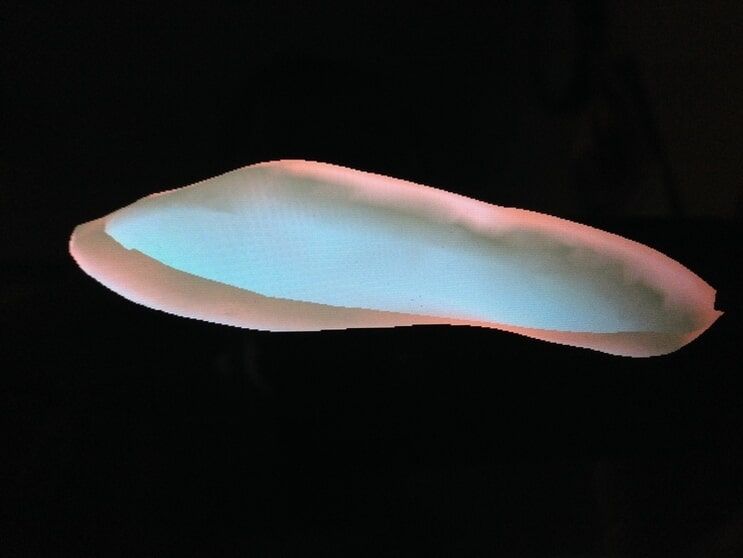 Highlighted foot bone — Foot surgery in Tampa, FL