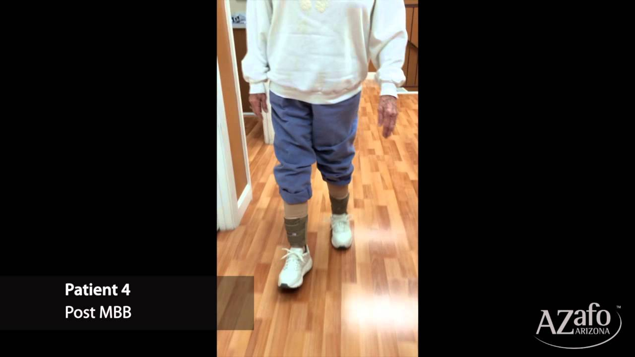 Professional Foot Surgery — Moore Balance Brace Item in Tampa, Fl