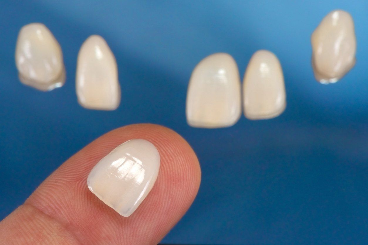 Hand holding a tooth-shaped veneer, with other dental veneers arranged on a blue surface.