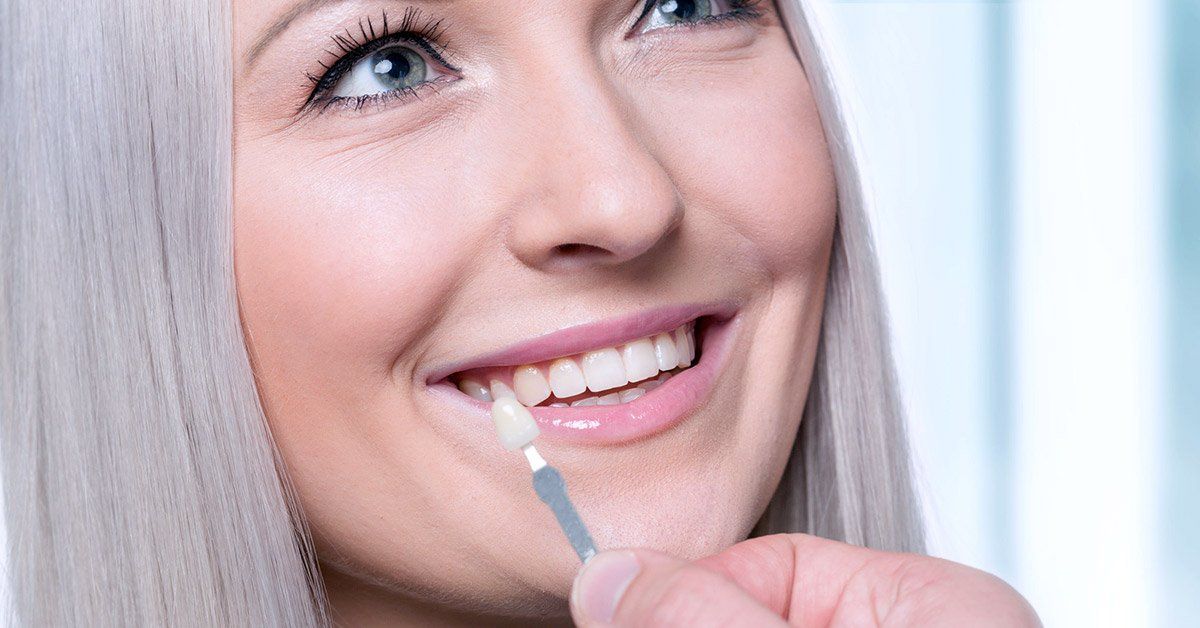 Woman smiling, having her teeth shade matched with a guide.