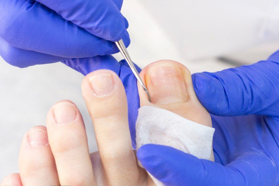 piede geriatrico