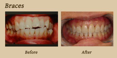 smile gallery 5