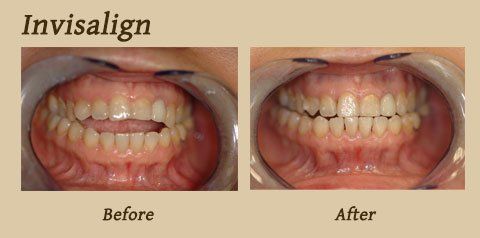 smile gallery 5