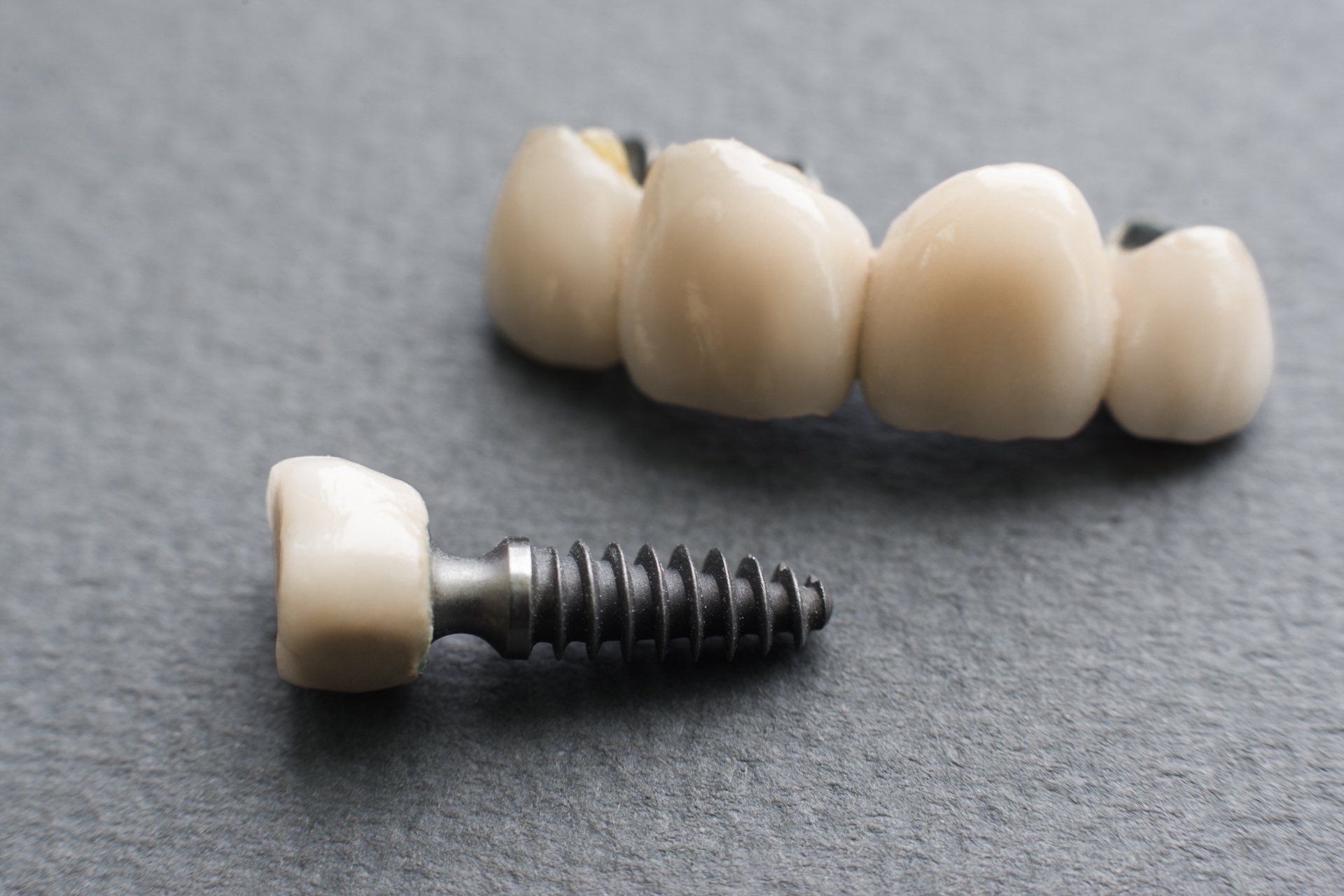 A dental bridge and a dental implant are on a table.
