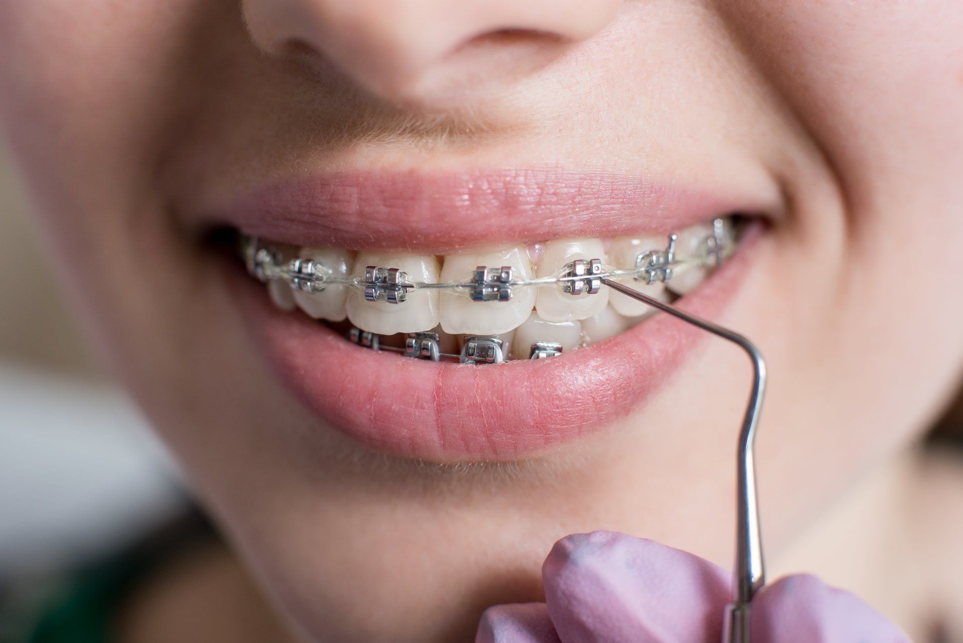 A woman with braces is getting her teeth examined by a dentist.