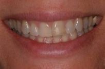 smile