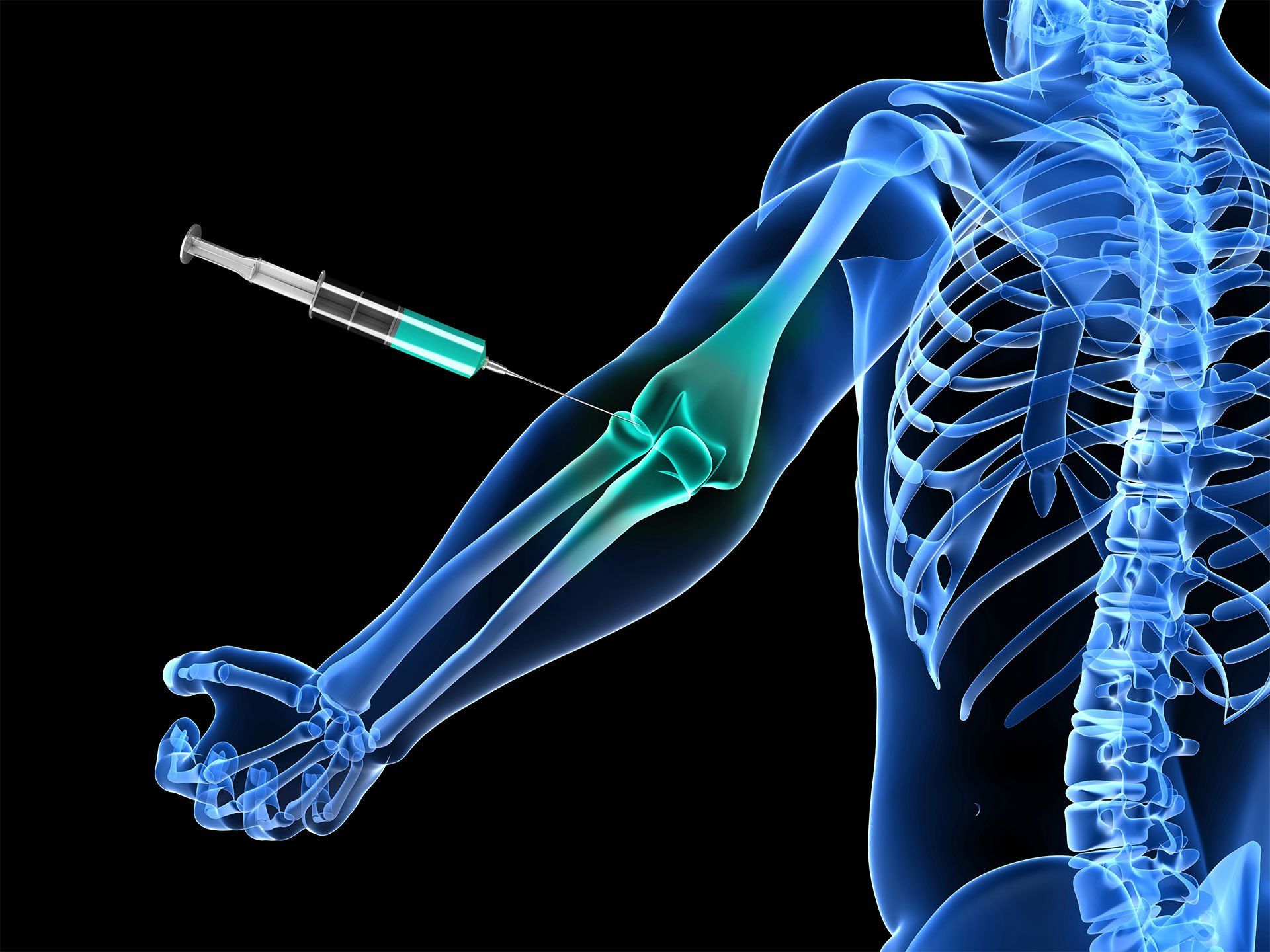 The Center for Spine & Sport Medicine | Fluoroscopic Guided Injections | Huntington Station, NY | Astoria, NY The Center for Spine & Sport Medicine | Fluoroscopic Guided Injections | Huntington Station, NY | Astoria, NY