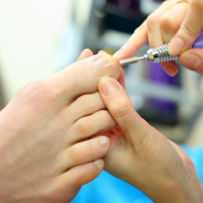 ingrowing toenails