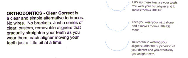 Orthodontics in Beatrice, NE 