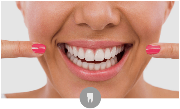 perfect teeth