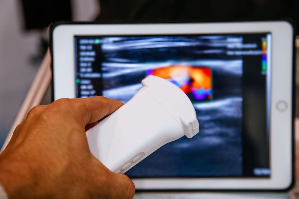 sonda ecocolordoppler