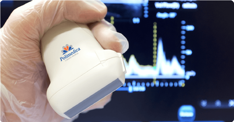 sonda per esame ecocolordoppler