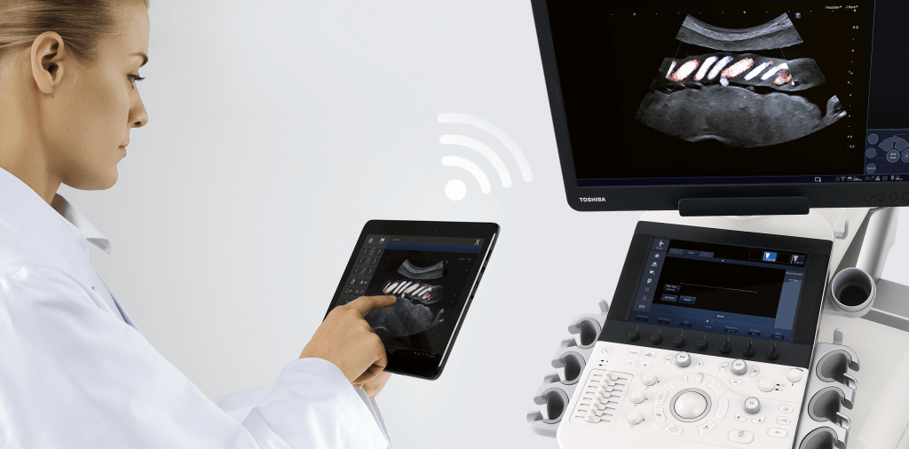 strumento per ecocolordoppler con connessione Wi Fi