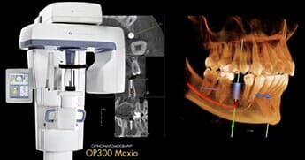 Ecocolordoppler